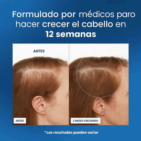 BODY WISE™ | ROLL-ON DE CRECIMINETO CAPILAR